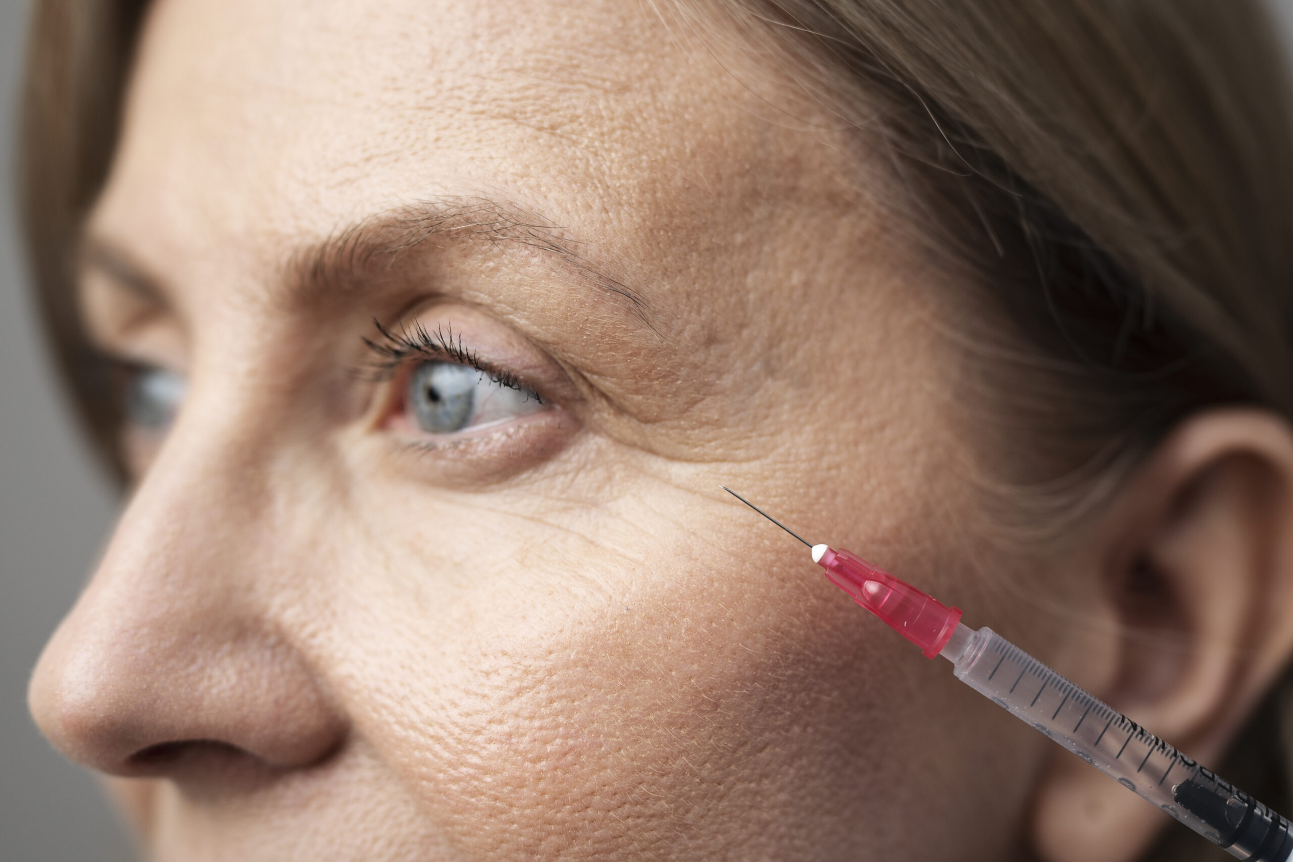 Tips for Natural-Looking Results with Anti-Wrinkle Injections